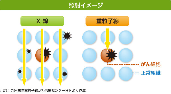 画像：照射イメージ